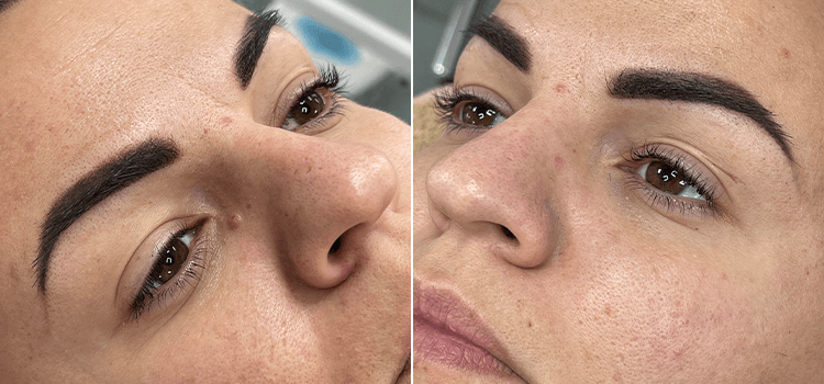 szemöldök tetoválás Debrecen